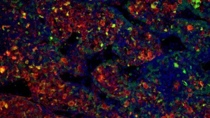 Chimeras Offer a New Way To Study Childhood Cancers In Mice
