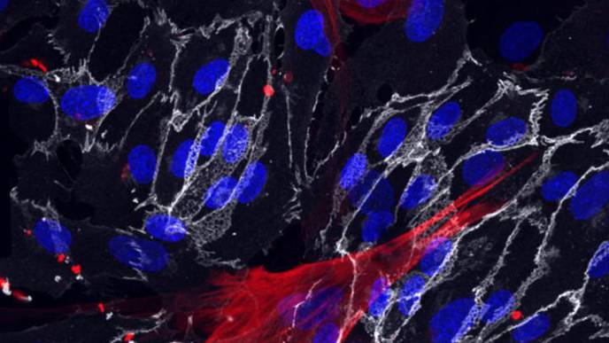 Method to Derive Blood Vessel Cells From Skin Cells Suggests Ways to Slow Aging