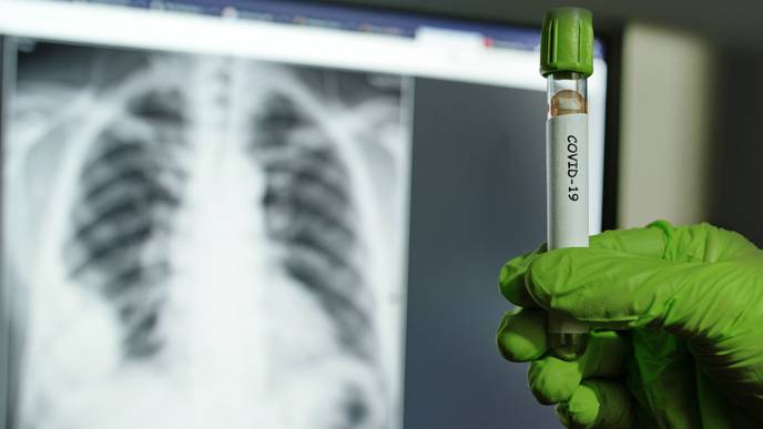 Scientists Discovered Biomolecule That Blocks COVID-19 Virus