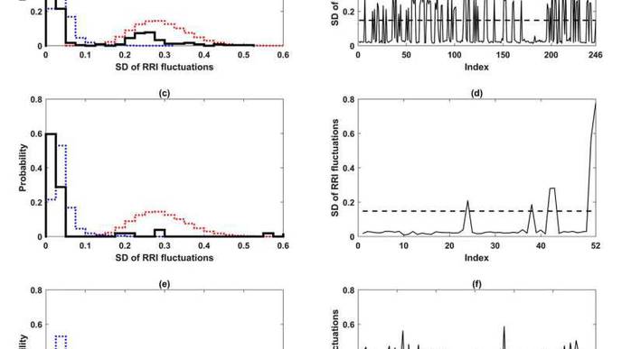 Critical Transition Theory Shows Flickering in Heart Before Atrial Fibrillation