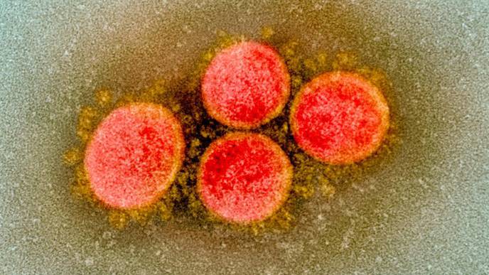 COVID-19 Patients May Have Lower Stroke Rates Than Previously Suggested