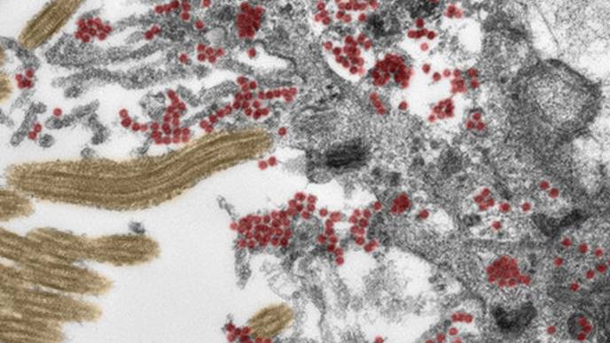 How SARS-CoV-2 Gets Into the Brain