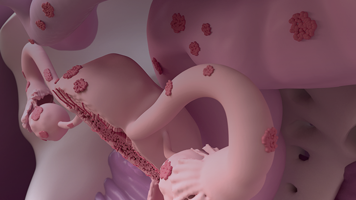 ReachMD Healthcare Image