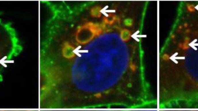 Halt Cell Recycling to Treat Cancer