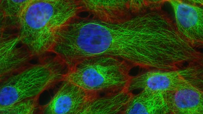 Personalized Blood Biopsies Could Provide Earlier Warning of Metastatic Cancer