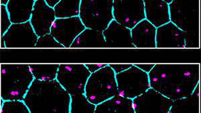 Recycling of the Eye's Light Sensors is Faulty in Progressive Blindness of Older Adults