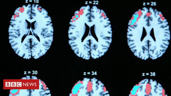 ECT Depression Therapy Should Be Suspended, Study Suggests