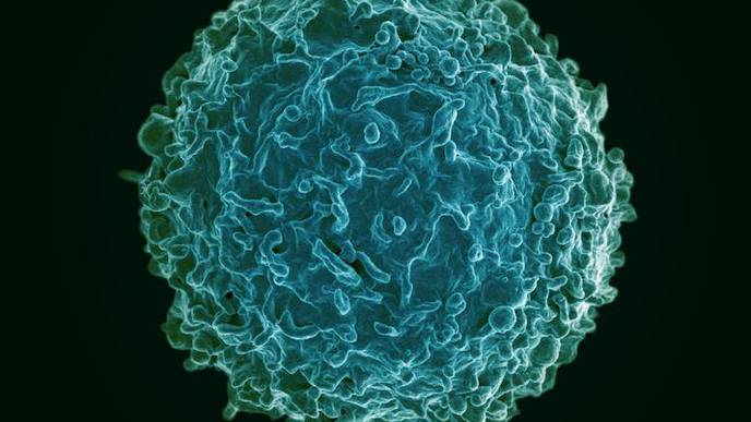 Blood Test Could Reveal When Rheumatoid Arthritis Will Strike