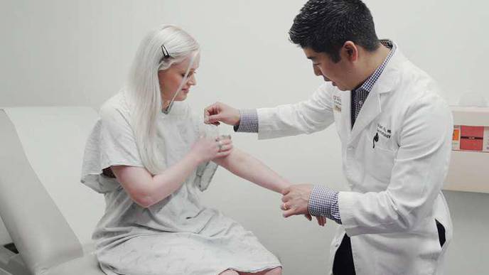 Revving Up Immune System May Help Treat Eczema
