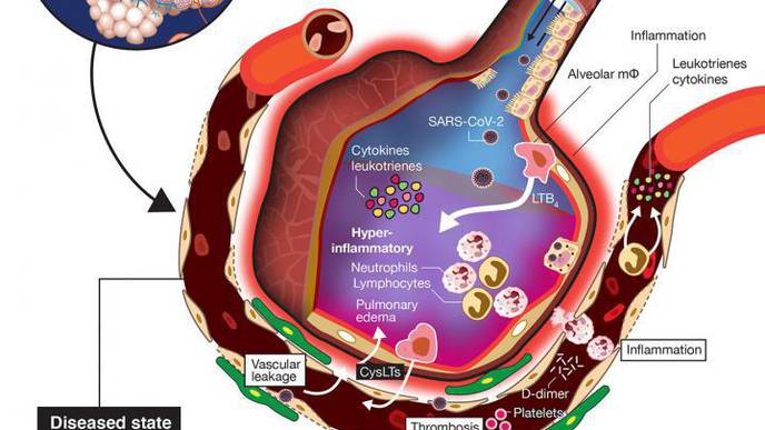 Novateur Ventures Explores New Strategy to Reduce Hyperinflammatory Response Caused by COVID-19