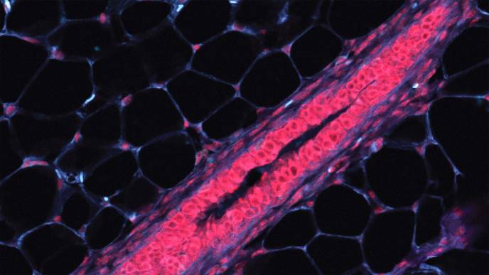 Cataloging Breast Cells to Find Cancer Origins