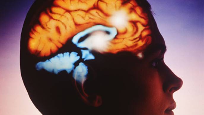Sexual Assault Tied to Psychogenic Nonepileptic Seizures in Women