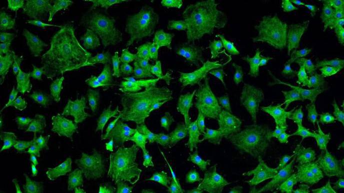 Patients Improve After Heart Cell Therapy