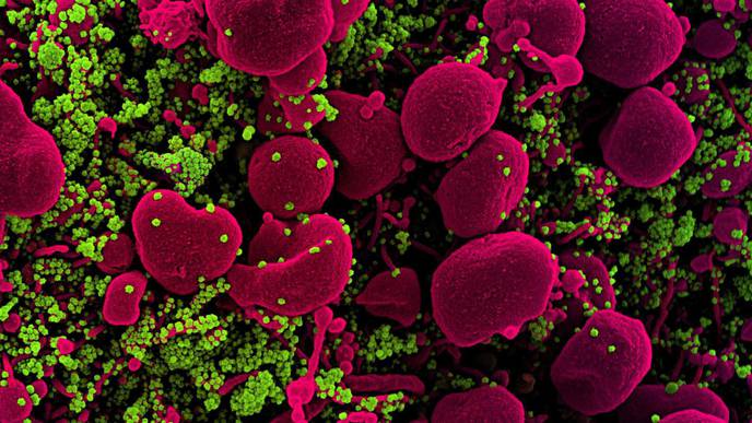 Two Studies Support Key Role for Immune System in Shaping SARS-CoV-2 Evolution
