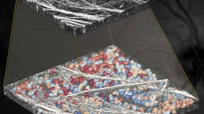 AI Spots Individual Neurons in the Eye Better Than Human Experts