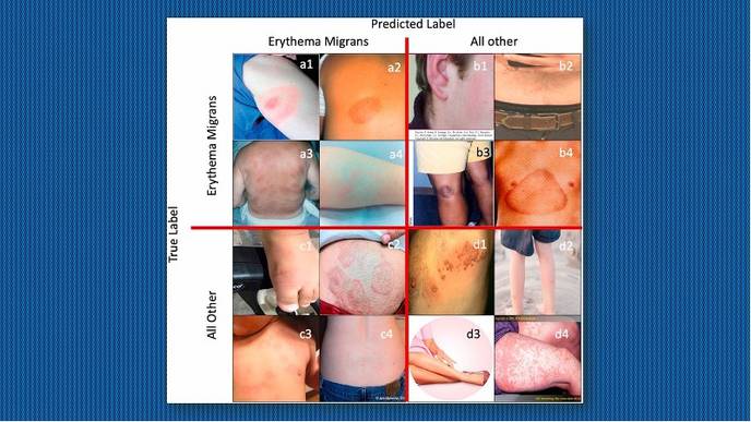 AI & Deep Learning Used For Better Lyme Disease Detection