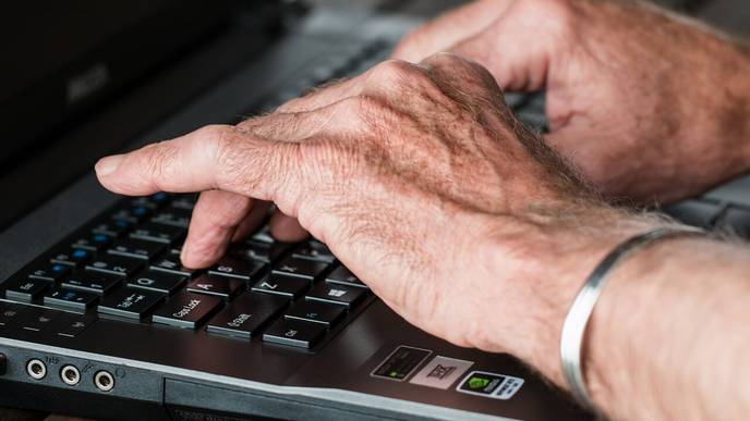 Arthritis Drugs Effective in Treating Dupuytren’s Disease
