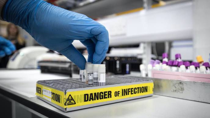 First Human Trial of Antibody Therapy for COVID-19 Has Begun