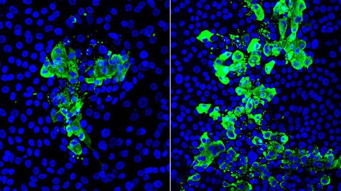 Study Reveals How Smoking Worsens COVID-19 Infection in the Airways