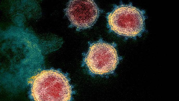 Model Analyzes How Viruses Escape the Immune System