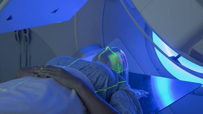 Dramatic Changes to Radiotherapy Treatments Due to COVID-19