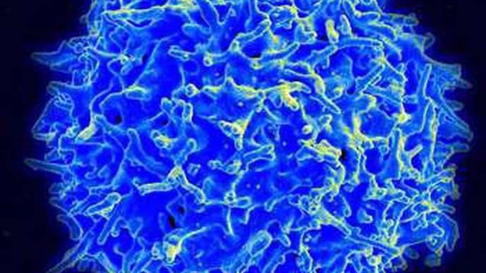 New Technique Predicts Which Melanoma Patients Are at Risk for Cancer Spread