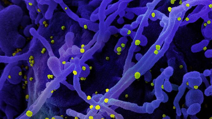 Investigators Hope CD47 Study Leads to Broad-Spectrum Infectious Diseases Immunotherapy