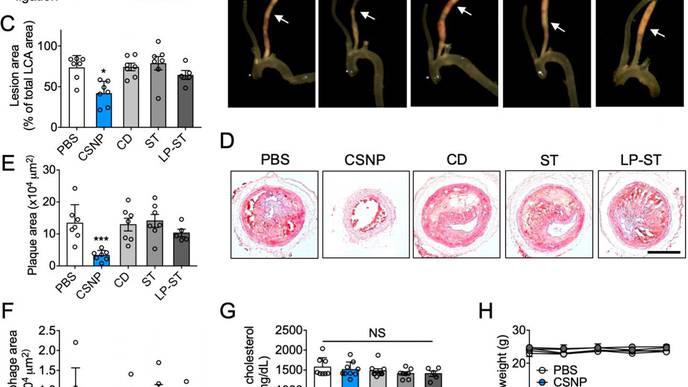New Nanoparticle Drug Combination for Atherosclerosis