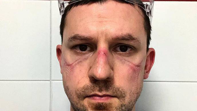 Healthcare Workers Around the World Share Photos After Hours Treating COVID-19 Patients
