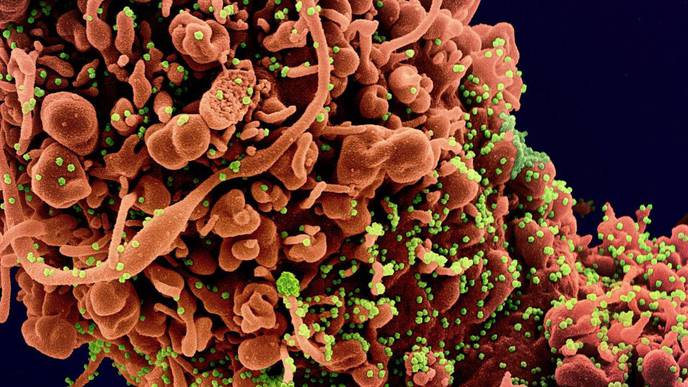 Coronavirus May Damage Testicles Without Entering Cells, Study Finds