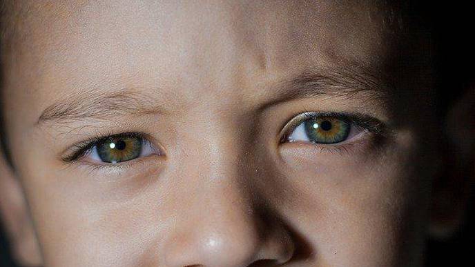 Blood Pressure Connected to Eye Health in Young Children