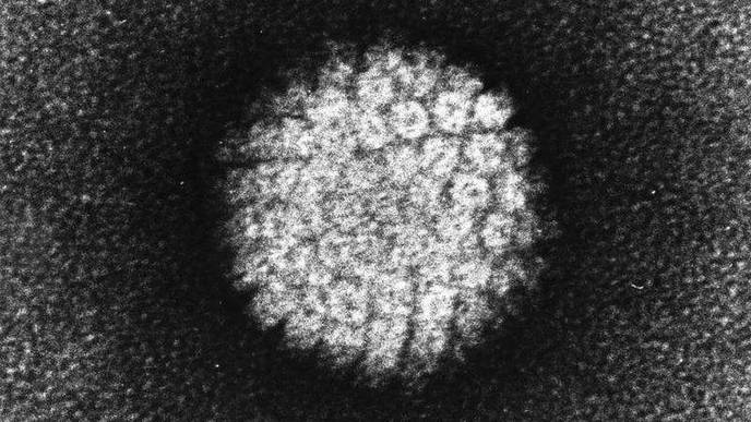 Yale Researchers Find New Approach That Can Stop HPV Infection