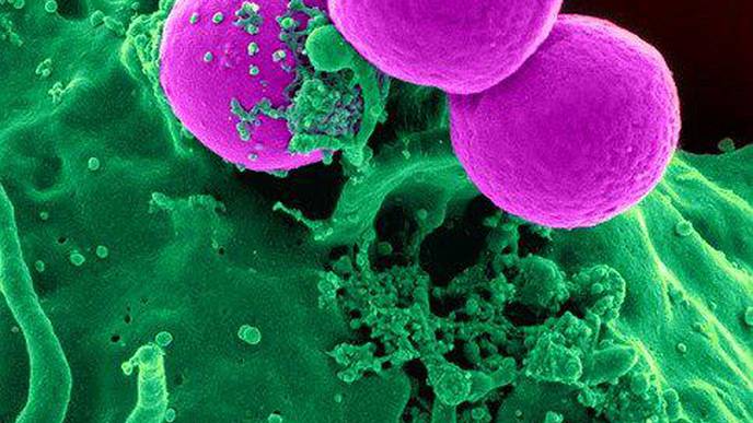 Blue Light May be the Key to Defeating MRSA