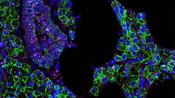 Scientists Find Evidence That Novel Coronavirus Infects the Mouth's Cells