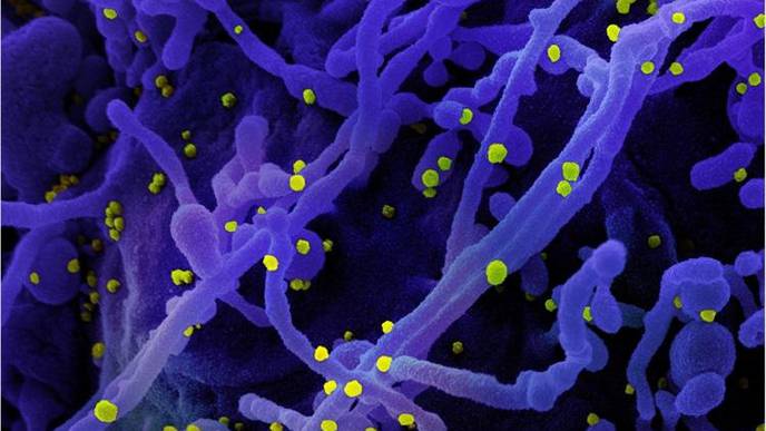 Antidepressant Fluoxetine (Prozac) Suppresses Replication of SARS-CoV-2
