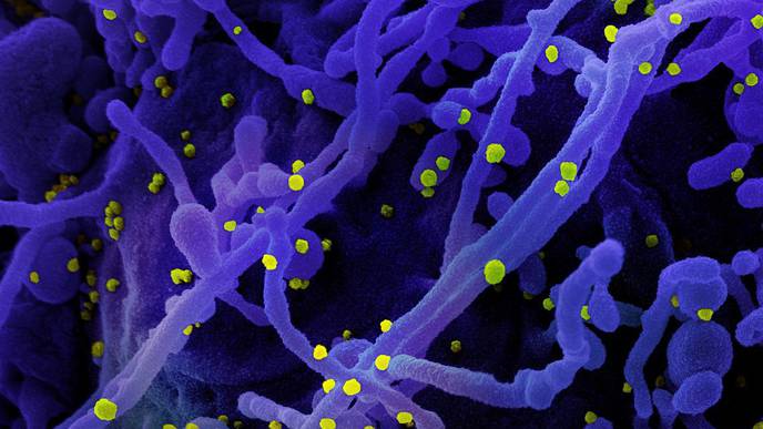 Investigators Hope CD47 Study Leads to Broad-Spectrum Infectious Diseases Immunotherapy