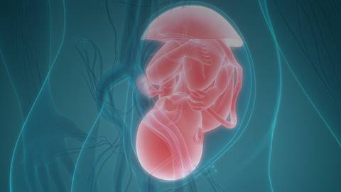Alloimmune Thrombocytopenia in the Fetus and Newborn