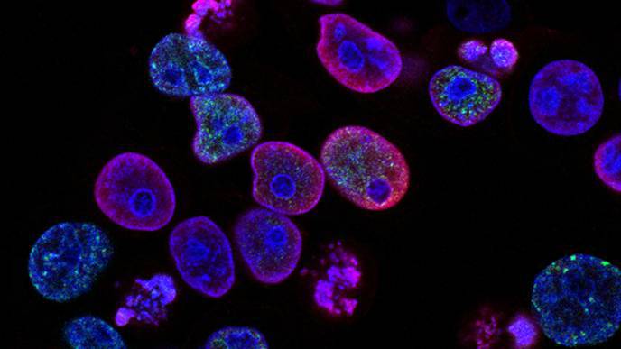 New Study Describes Which Cancer Patients are More Vulnerable to Coronavirus