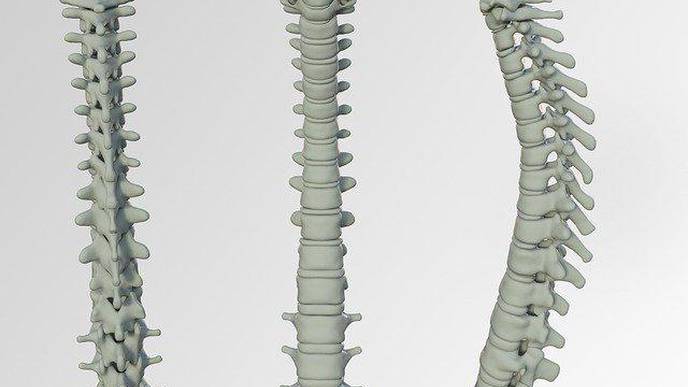 Spine Infection Detected in Elderly Patients After COVID-19 Recovery