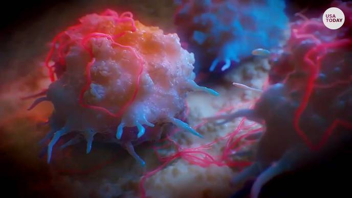 COVID-19: Americans Keep Canceling Cancer Screenings